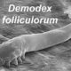 Demodex Mites: Link to Chronic Dry Eye Issues Explained